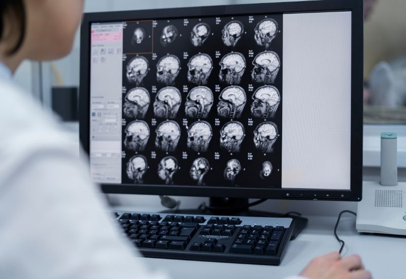 U não là một trong những bệnh lý nguy hiểm nhưng ít được phát hiện sớm