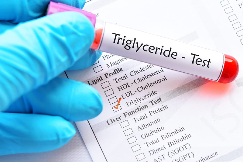 Xét nghiệm Triglyceride cung cấp cơ sở để bác sĩ đánh giá tình trạng mỡ máu