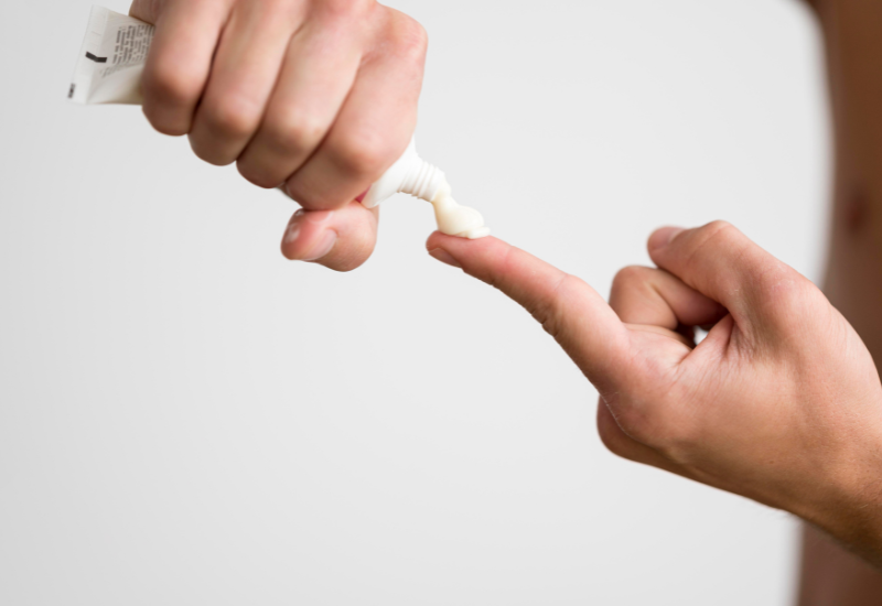 Điều trị bằng thuốc bôi ngoài da với các chế phẩm chứa corticosteroid thường được chỉ định để điều trị u hạt vòng