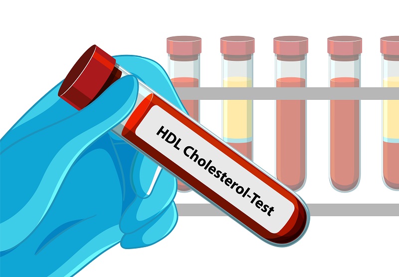 Xét nghiệm sinh hóa máu theo dõi chỉ số HDL giúp đánh giá nguy cơ tim mạch