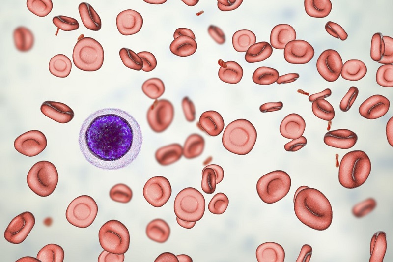 Tìm hiểu bệnh hồng cầu nhược sắc là gì dấu hiệu và cách điều trị