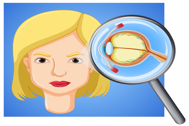 Bệnh thoái hóa điểm vàng không được kiểm soát tốt dễ gây mù lòa