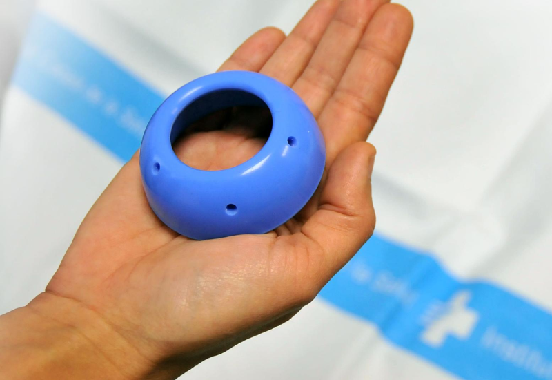 Vòng nâng cổ tử cung được đặt vào trong âm đạo, bao quanh cổ tử cung giúp hạn chế nguy cơ cổ tử cung mở sớm