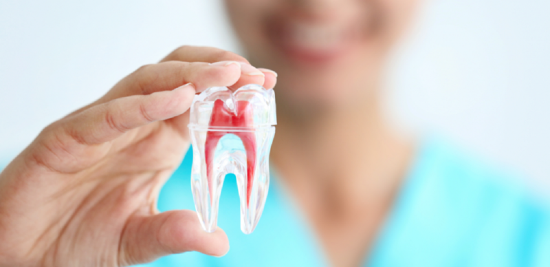 Lấy tủy răng cần bao lâu để hoàn thành quá trình?
