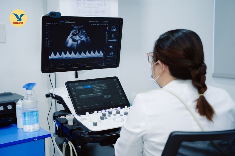 “Chỉ số GS trong siêu âm thai là gì” được nhiều mẹ bầu thắc mắc khi xem kết quả siêu âm thai