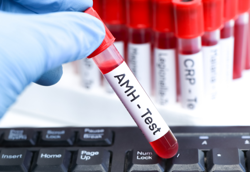 Xét nghiệm amh bao lâu có kết quả là câu hỏi nhiều chị em quan tâm