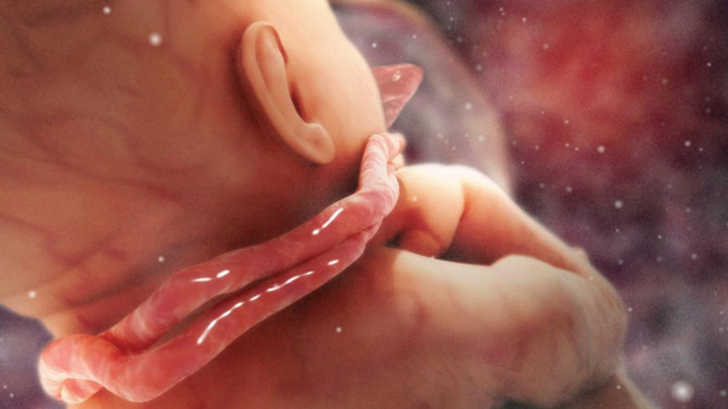 Có nhiều nguyên nhân khiến thai nhi bị dây rốn quấn cổ 1 vòng 