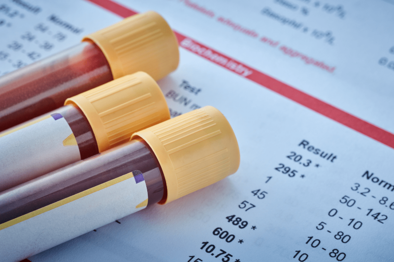 Xét nghiệm chức năng thận có vai trò quan trọng trong tầm soát, chẩn đoán bệnh lý thận 