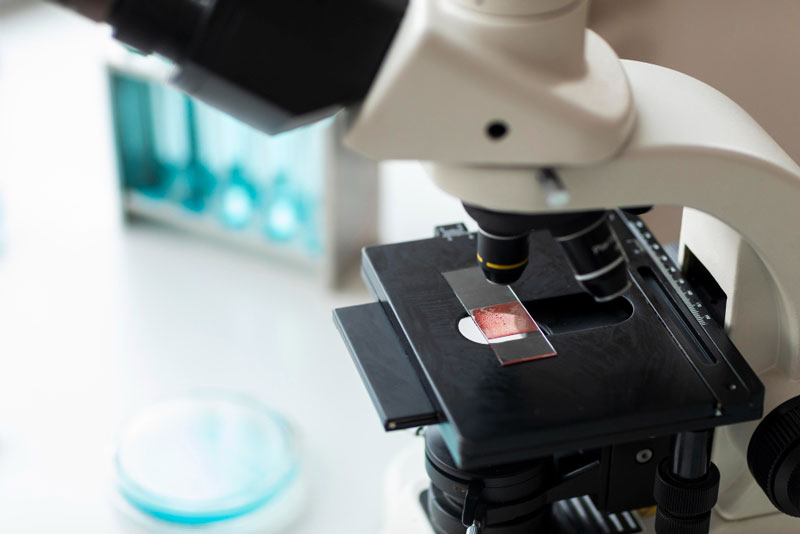 Phương pháp sinh thiết giúp kiểm tra khối hạch có chứa tế bào ung thư hay không