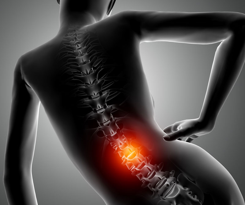 Vận động sai tư thế trong thời gian dài dễ dẫn đến tình trạng gai cột sống thắt lưng