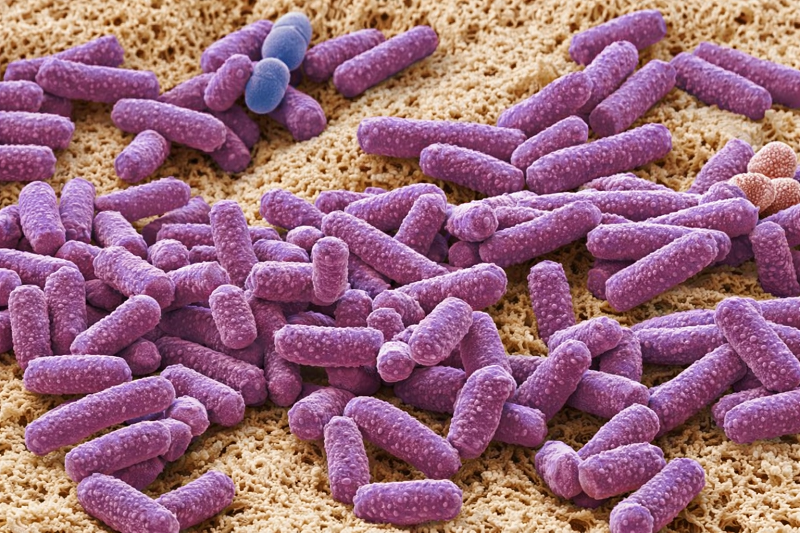 Vi khuẩn tụ huyết trùng có thể tồn tại trong máu, nội tạng và mô cơ của gà bệnh.