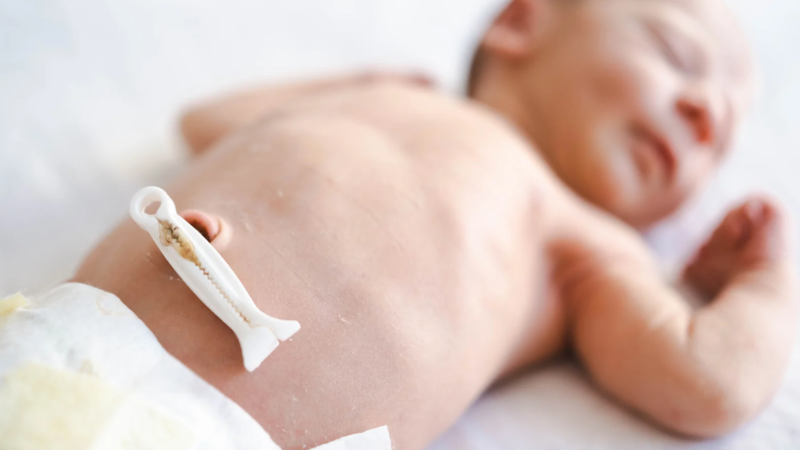 Rốn khô sạch không sưng đỏ không mùi hôi được coi là bình thường 