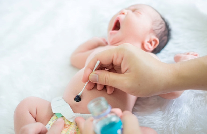 Vệ sinh rốn đúng cách giúp phòng ngừa nhiễm trùng