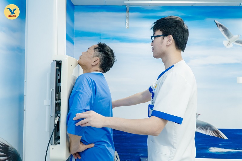 Khí phế quản đồ có thể phát hiện trên kết quả phim chụp X-quang phổi