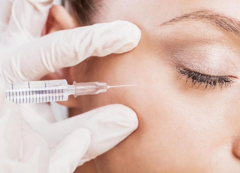 Thời gian thực hiện tiêm HA thường kéo dài khoảng 15 - 30 phút tùy theo vùng điều trị