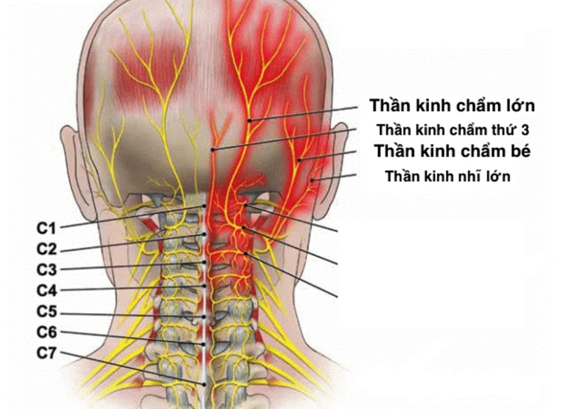 Đau dây thần kinh chẩm là nguyên nhân phổ biến gây đau đầu ở người lớn tuổi. Ảnh minh họa
