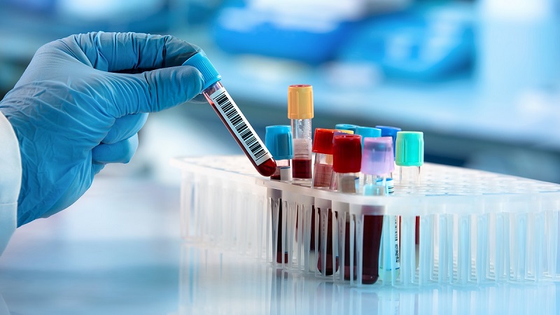 Quy trình lấy máu xét nghiệm sinh hóa như thế nào?