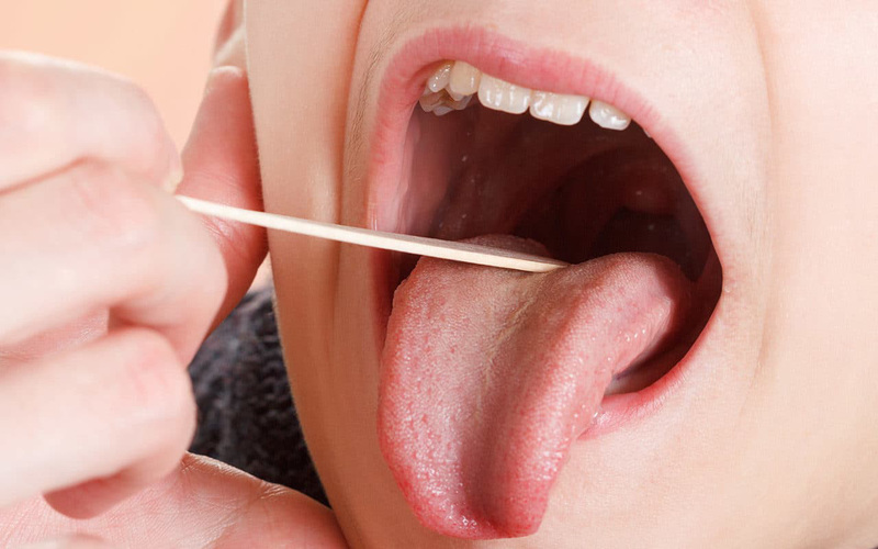 Các biện pháp chữa trị đau họng amidan bằng phương pháp tự nhiên
