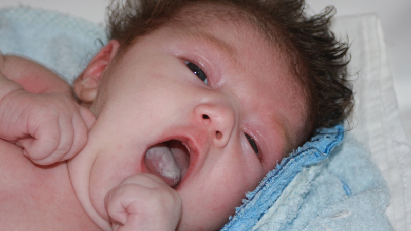 Trẻ xuất hiện mảng trắng trong miệng là dấu hiệu đẹn tang