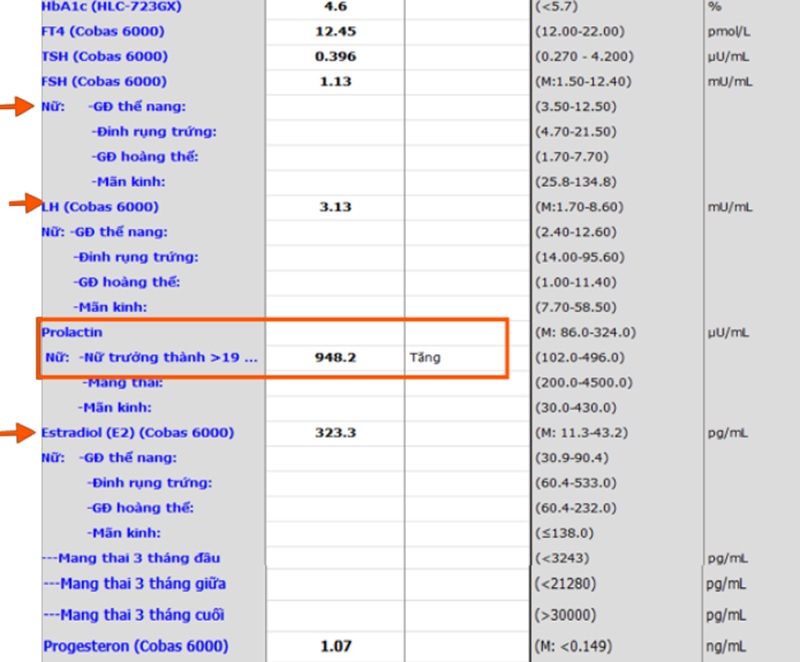 Kết quả xét nghiệm của bệnh nhân cho thấy E2 và prolactin máu tăng cao 