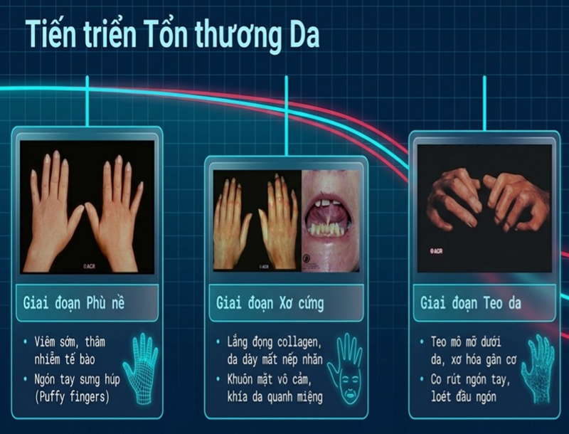 Các giai đoạn tiến triển tổn thương da 