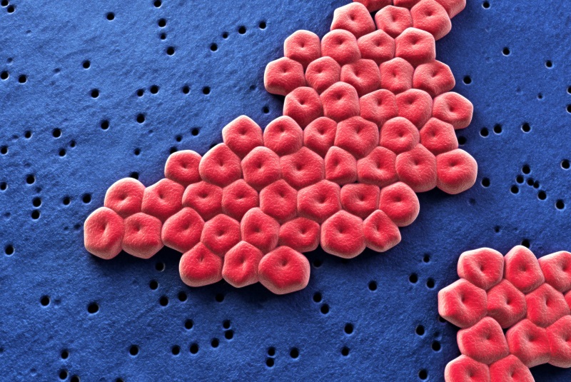 Acinetobacter baumannii là tác nhân thường phải điều trị bằng colistin