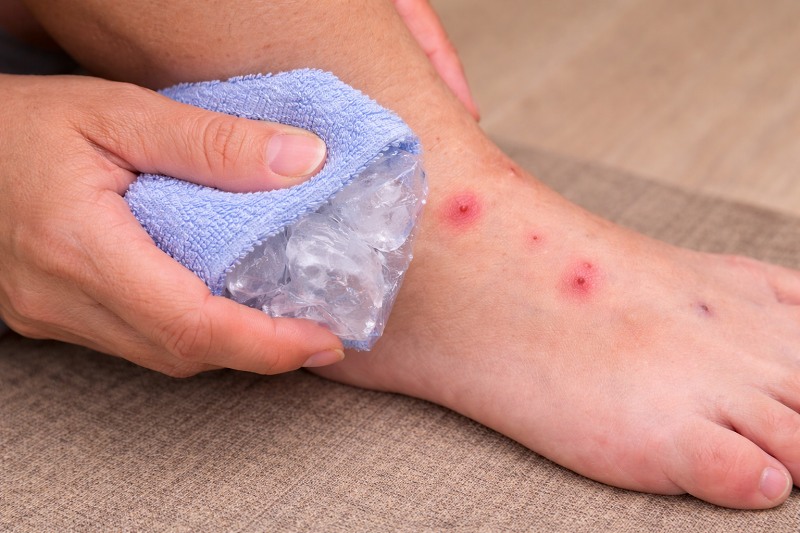 Bạn có thể chườm lạnh trong khoảng 10 - 15 phút để làm dịu cảm giác ngứa và hạn chế sưng