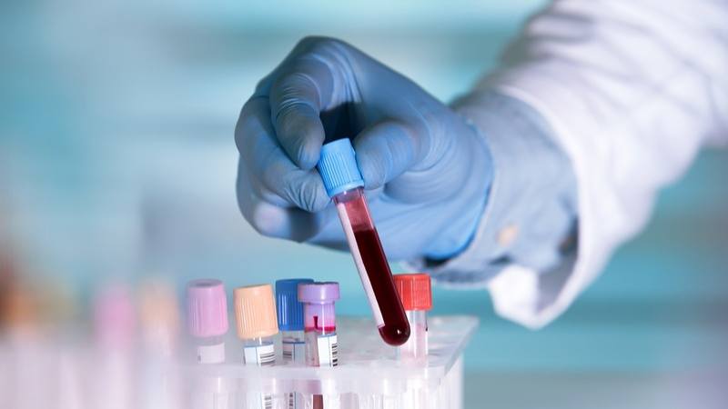 Xét nghiệm sùi mào gà bao lâu có kết quả - câu trả lời phụ thuộc vào nhiều yếu tố