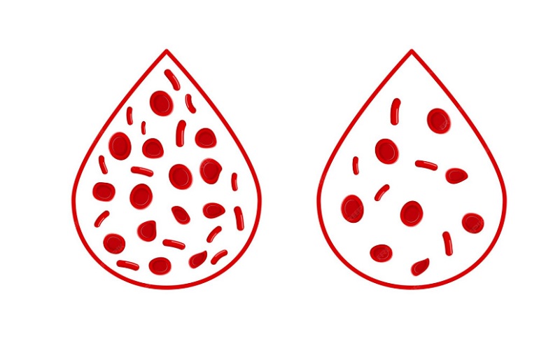 Bệnh Thalassemia có thể dẫn đến chỉ số HbA thấp HbF cao ở trẻ sơ sinh