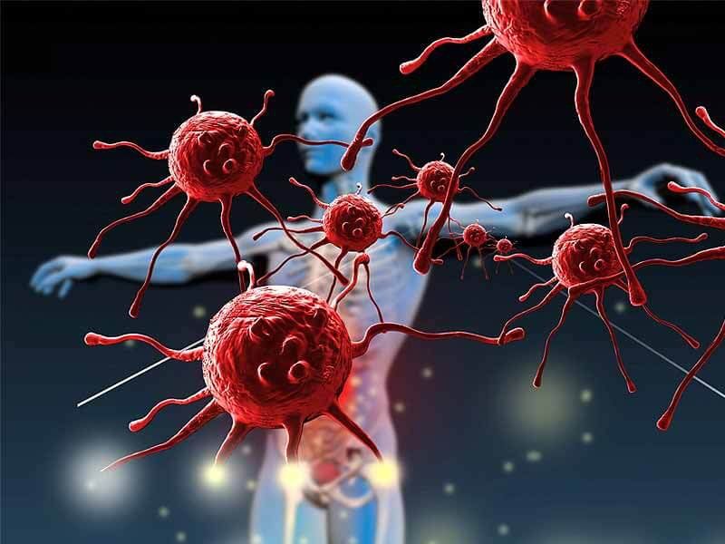 Bệnh tự miễn xảy ra khi hệ miễn dịch của cơ thể tấn công nhầm các cơ quan khỏe mạnh 