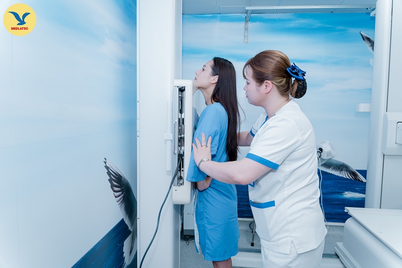 Chụp X-quang ngực giúp xác định tổn thương mô kẽ hai bên