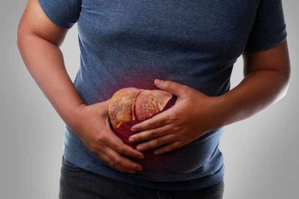 Ung thư gan là nguyên nhân gây tử vong hàng đầu do ung thư tại Việt Nam