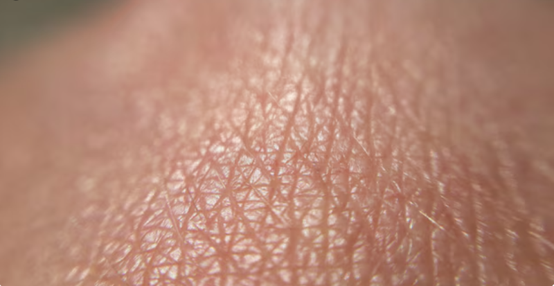 Tình trạng da khô có thể là nguyên nhân khiến da trẻ bị nổi sần như da gà