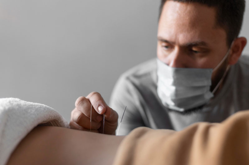 Thúc đẩy khí huyết luân chuyển thông qua liệu pháp châm cứu tác động vào các huyệt vị