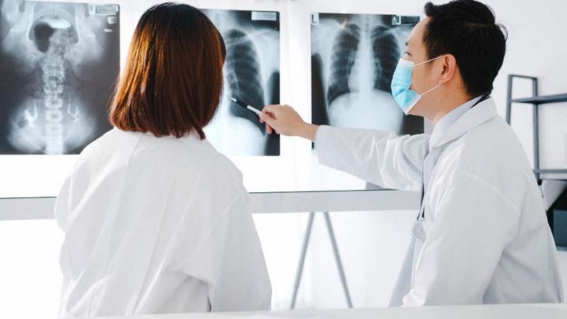 Tràn dịch màng phổi là tình trạng dịch trong khoang màng phổi vượt quá mức trung bình 