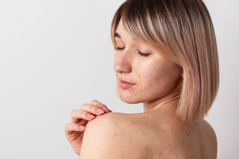 Đốm đỏ ung thư máu - triệu chứng cảnh báo không nên xem thường 