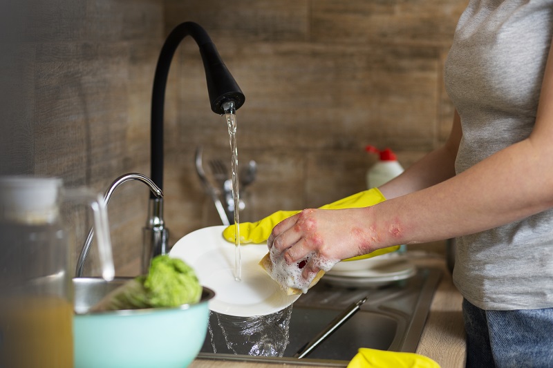 Tiếp xúc thường xuyên với chất tẩy rửa là yếu tố thúc đẩy viêm da cơ địa tái phát dễ dàng