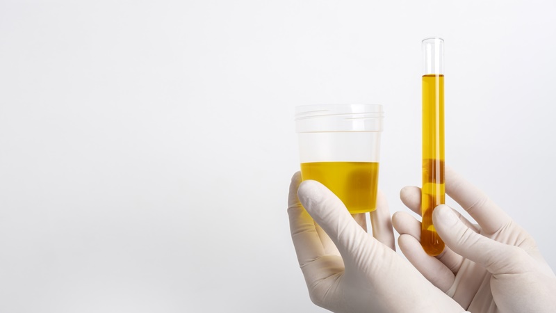 Kết quả xét nghiệm nước tiểu giúp bác sĩ có thể đánh giá được tình trạng protein niệu và nguy cơ tiền sản giật