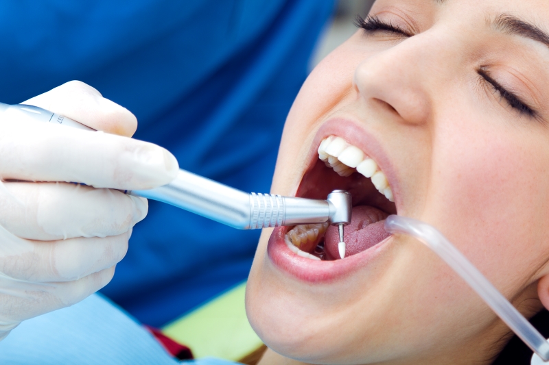 Thời gian thực hiện trám răng kéo dài khoảng 15 - 20 phút