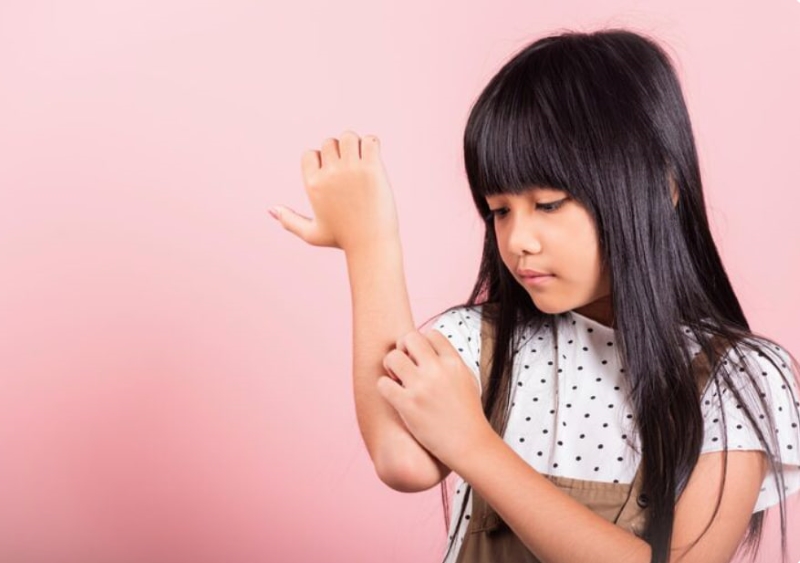 Da khô kéo dài là nguyên nhân thường gặp gây ngứa toàn thân ở trẻ nhỏ