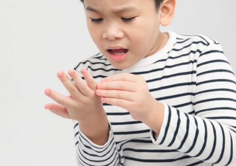 Bệnh tay chân miệng có thể khiến da trẻ xuất hiện mụn nước, sưng đỏ và khó chịu