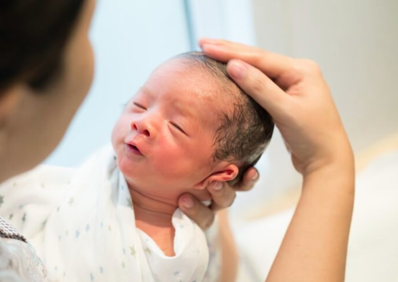 Da đầu trẻ sơ sinh xuất hiện các mảng vảy vàng đặc trưng của cứt trâu