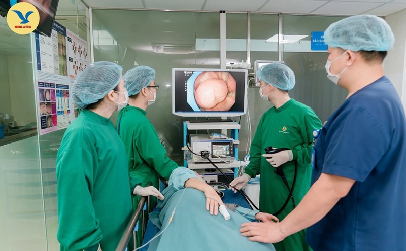 Nội soi là phương pháp thường dùng trong sàng lọc ung thư tiêu hóa