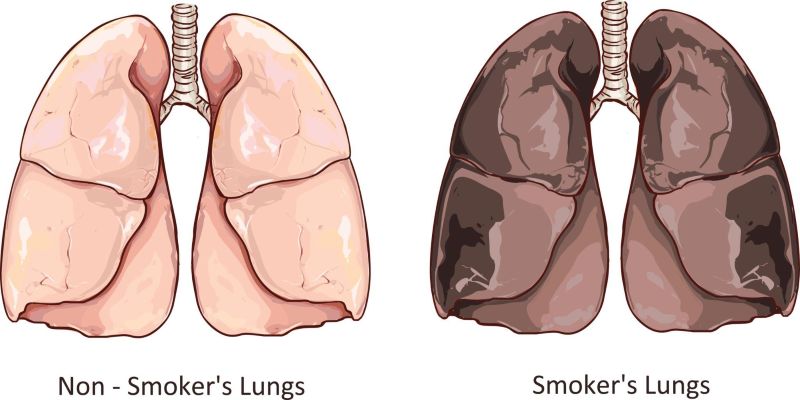 Người hút thuốc lá hắc ín ngưng tụ thành lớp nhựa màu nâu sẫm trong nang phổi
