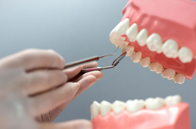 Trám răng giúp việc ăn nhai dễ dàng hơn
