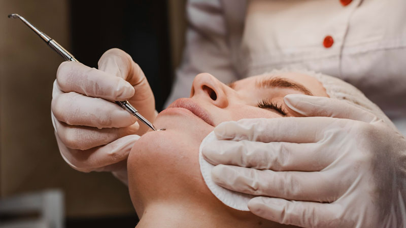 Các biện pháp y khoa da liễu sẽ giúp cải thiện tình trạng mụn rõ rệt