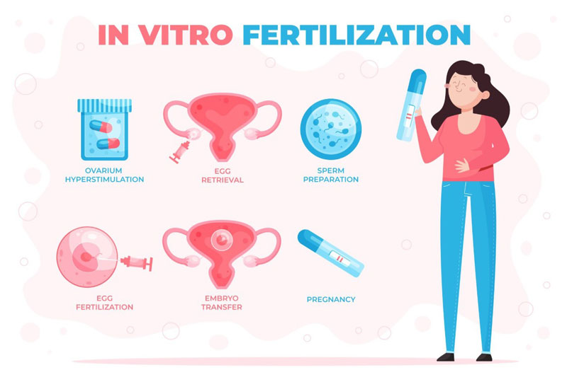 Canh niêm mạc chuyển phôi là một bước quan trọng trong hành trình IVF