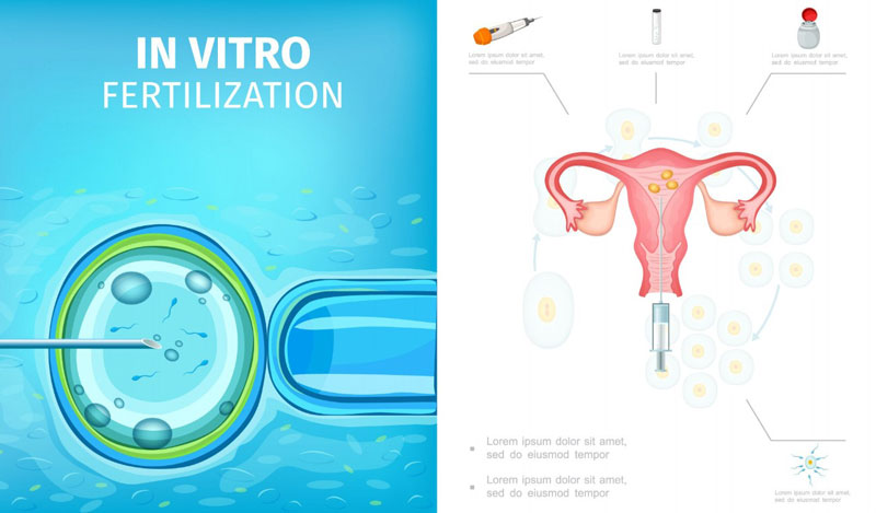 Quá trình canh niêm mạc chuyển phôi sẽ được theo dõi và thực hiện bởi các bác sĩ chuyên khoa