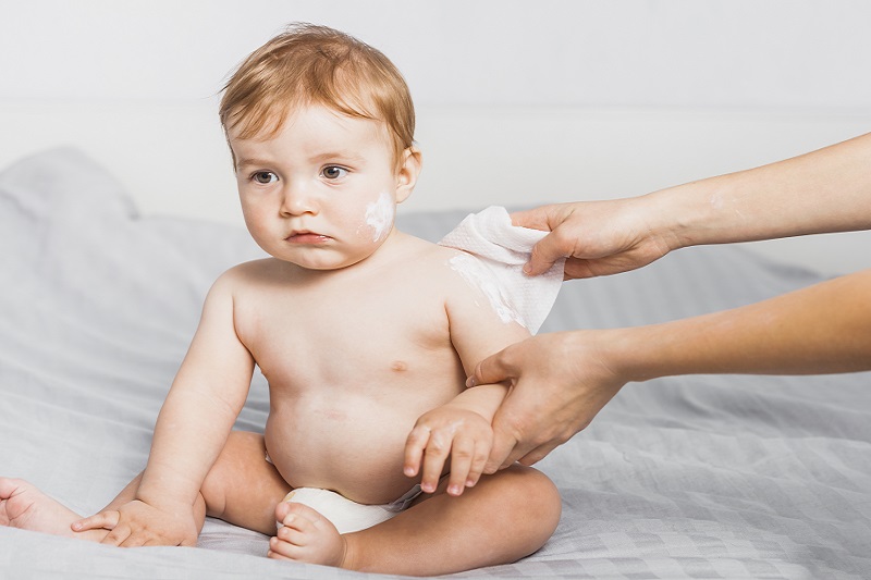 Sau khi thoa su bạc, cha mẹ nên quan sát phản ứng trên da của trẻ