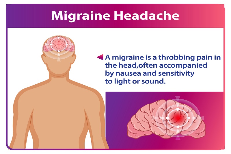 Bệnh Migraine dễ bị kích hoạt gây đau nửa đầu sau khi đi nắng về